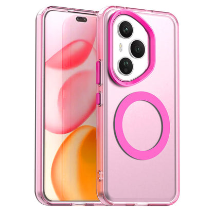 MagSafe Case for Honor 400 Pro, Techsuit, CandyCase, Pink